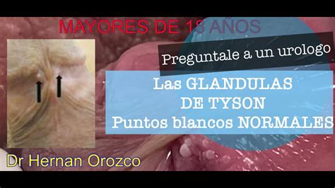 que son las glandulas tyson|Glándulas de Tyson